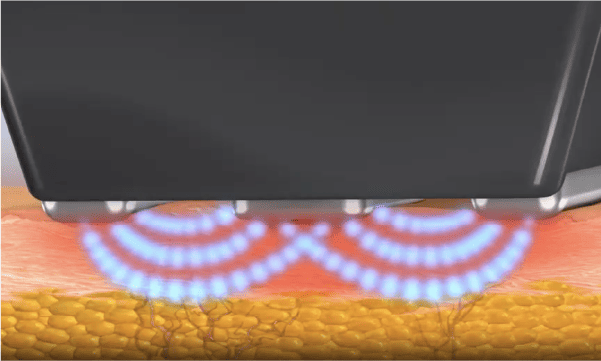 Formaのメカニズム